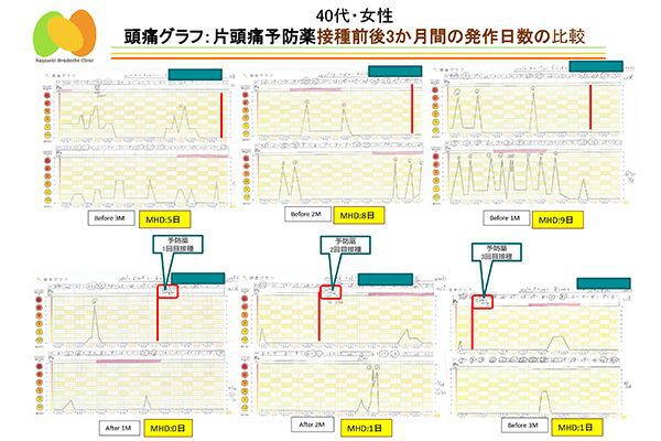 ながせき頭痛グラフ